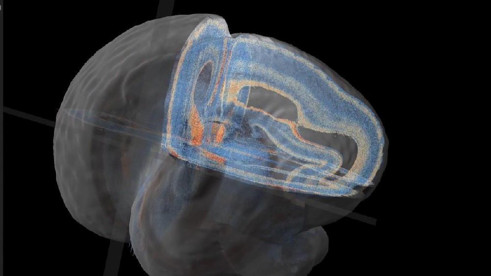 借助視覺問答和多模態檢索推進神經科學研究